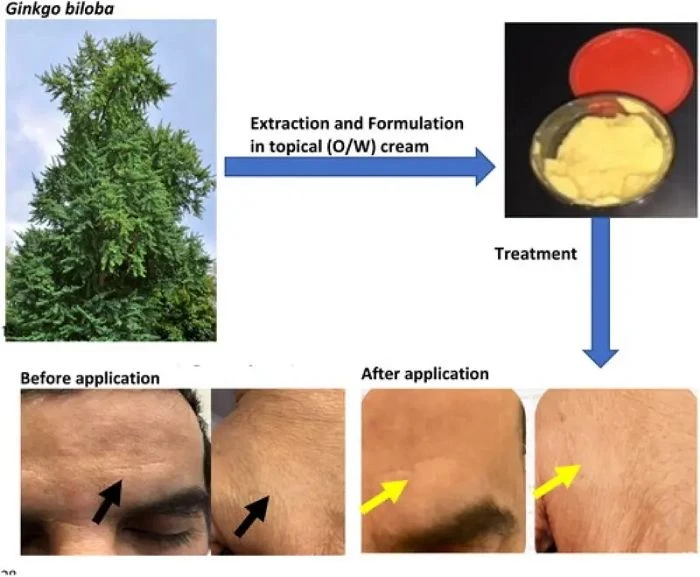 Skin-Beneficial Properties of Ginkgo Biloba Extract Skin-Beneficial Properties of Ginkgo Biloba Extract
